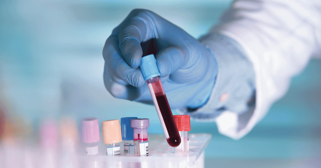 Comité Científico de Hemofilia, von Willebrand y Otras Alteraciones de la Coagulación