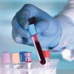 Comité Científico de Hemofilia, von Willebrand y Otras Alteraciones de la Coagulación